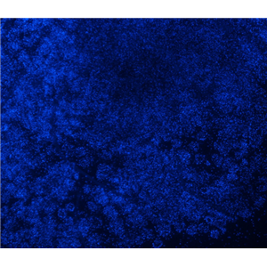 人肺癌成纤维细胞,Human lung cancer fibroblasts