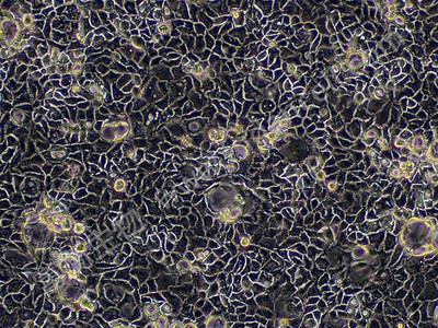 人结肠癌细胞；Caco2,Caco2