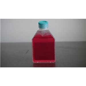 Hela；人宫颈癌细胞 (STR),Hela