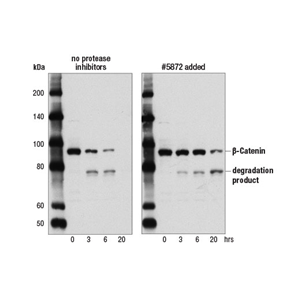 蛋白酶/磷酸酶抑制剂混合物（100×）