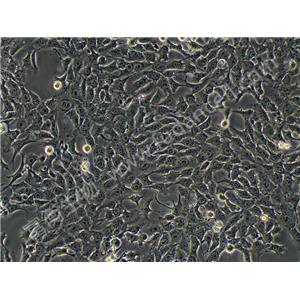 小鼠乳腺癌细胞；4T1