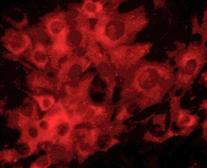 小鼠脉络膜黑色素细胞,Mouse choroidal melanocytes