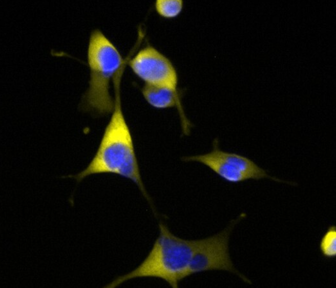 小鼠肾脏巨噬细胞,Mouse kidney macrophages