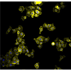 兔视网膜前体细胞,Rabbit retinal progenitor cells