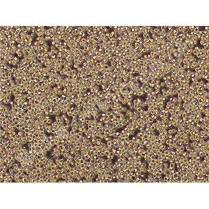 人原髓细胞白血病细胞；HL-60