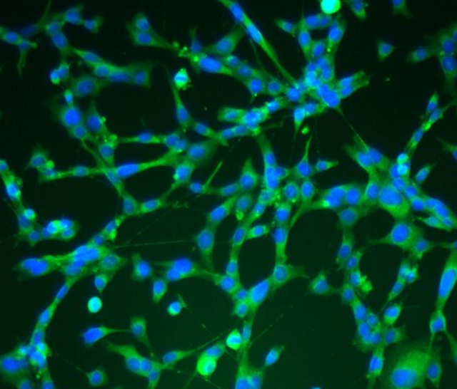 兔肝动脉平滑肌细胞,Rabbit hepatic artery smooth muscle cells