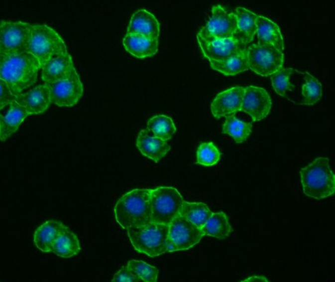兔真皮微血管内皮细胞,Rabbit dermal microvascular endothelial cells