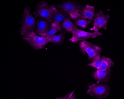 兔胰岛β细胞,Rabbit pancreatic beta cells