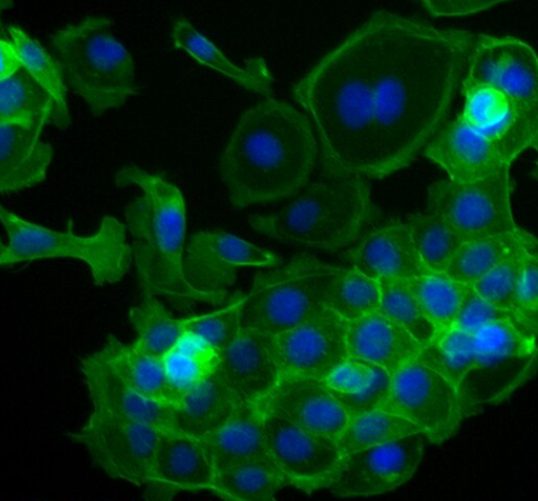小鼠小气道平滑肌细胞,Mouse small airway smooth muscle cells