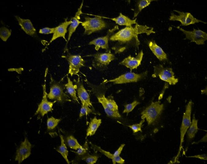 小鼠气管成纤维细胞,Mouse tracheal fibroblasts