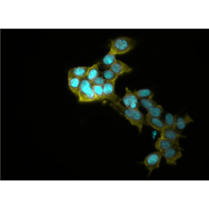 兔脊髓成纤维细胞,Rabbit spinal cord fibroblasts