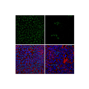 WRN (8H3) 小鼠单克隆抗体