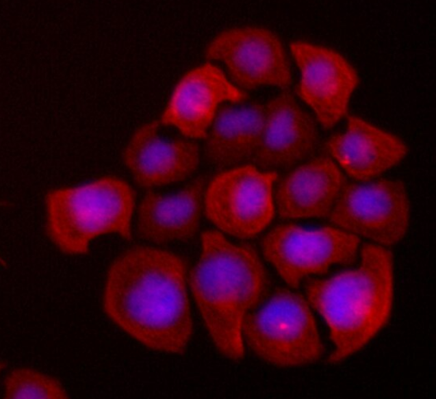 兔关节囊成纤维细胞,Rabbit articular capsule fibroblasts