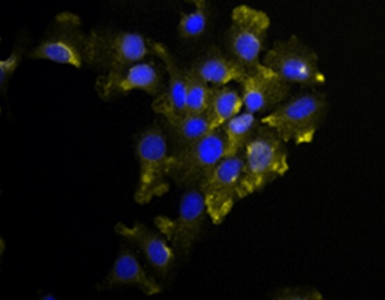 兔前列腺基质细胞,Rabbit prostate stromal cells