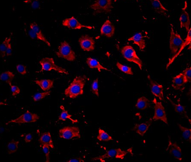 兔肾动脉平滑肌细胞,Rabbit renal artery smooth muscle cells