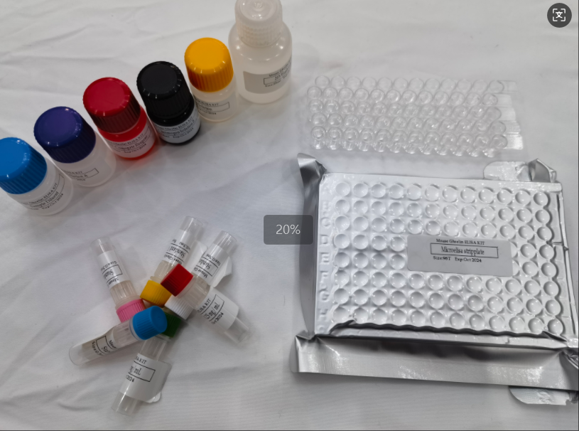 小鼠基质金属蛋白酶1（MMP-1）ELISA试剂盒,Mouse MMP-1(Matrix Metalloproteinase 1) ELISA Kit