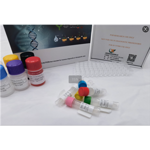 小鼠钥孔虫戚血蓝蛋白IgA(Anti-KLH IgA) ELISA试剂盒,Mouse Anti-KLH IgA(Keyhole Limpet Hemocyanin IgA) ELISA Kit