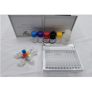 小鼠Dickkopf相关蛋白3 (DKK3) ELISA试剂盒,Mouse Dkk3(Dickkopf-related protein 3) ELISA Kit