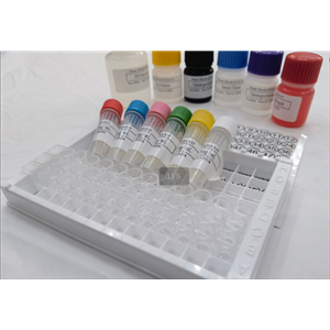 小鼠Dickkopf相关蛋白3 (DKK3) ELISA试剂盒,Mouse Dkk3(Dickkopf-related protein 3) ELISA Kit