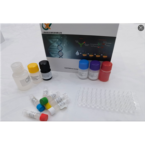 小鼠γ谷氨酰转移酶1 (GGT1) ELISA试剂盒,Mouse Ggt1(Gamma-glutamyltranspeptidase 1) ELISA Kit