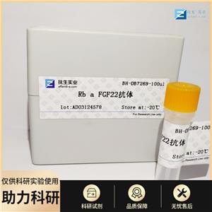 FC段γ受体3/免疫球蛋白G Fc段受体III抗体,CD16 Rabbit pAb