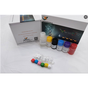 心语检测 大鼠髓鞘碱性蛋白ELISA试剂盒,Rat Myelin Basic Protein (MBP) ELISA Kit