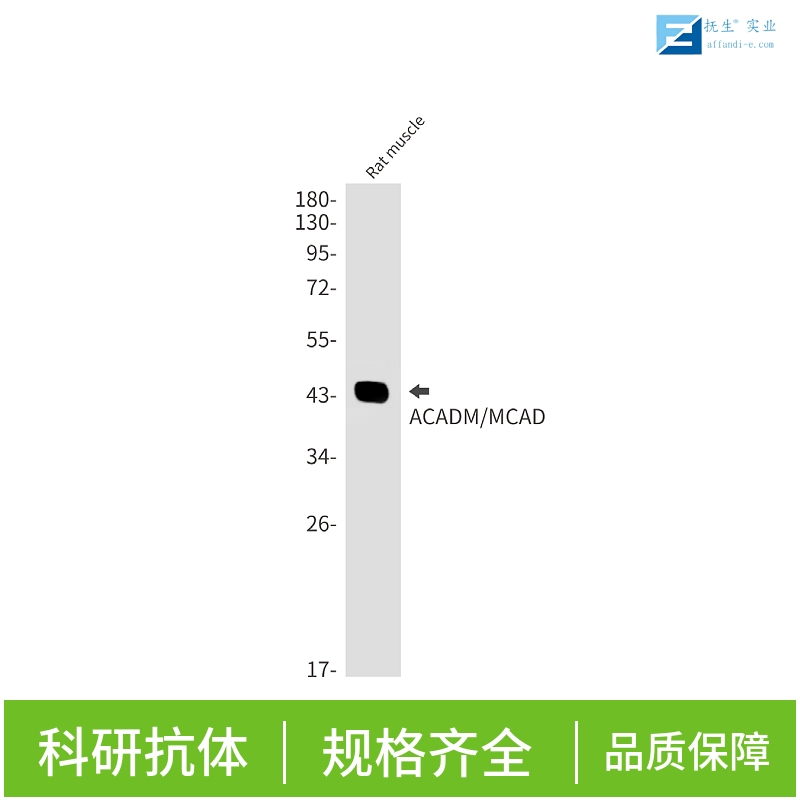 电压开启的钠离子通道SCN9A抗体,NAV1.7 Rabbit pAb