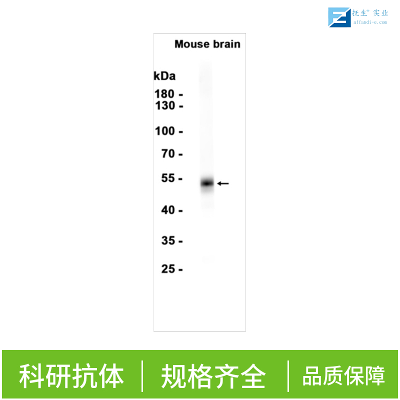 端粒体复制结合因子1抗体,TRF1 Rabbit pAb