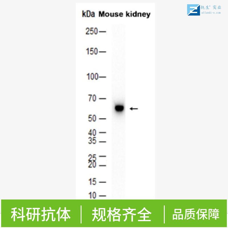 多巴胺受体D2抗体,DRD2 Rabbit pAb