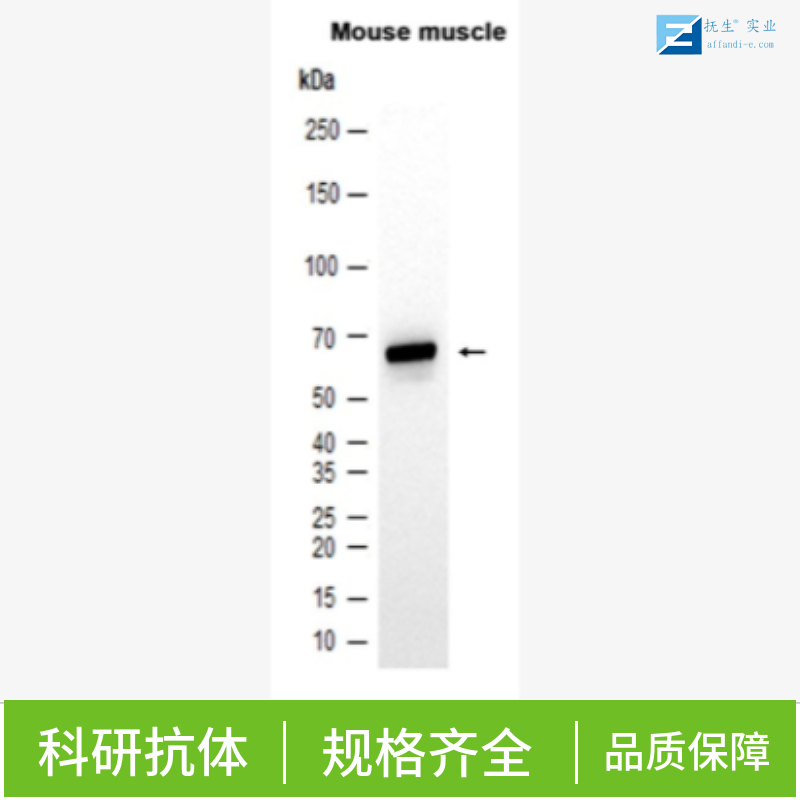 多腺苷二磷酸多聚酶抗体/多聚ADP-核糖聚合酶1抗体,PARP1 Rabbit pAb