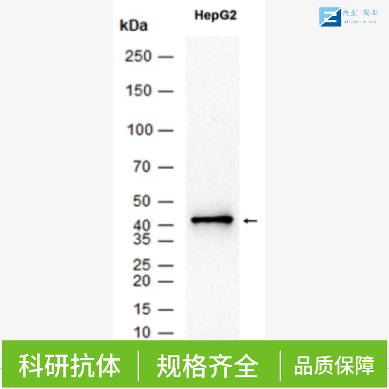 多药耐药相关蛋白2抗体,MRP2/ABCC2 Rabbit pAb
