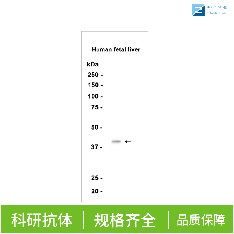 干扰素调节因子7抗体,IRF7 Rabbit pAb