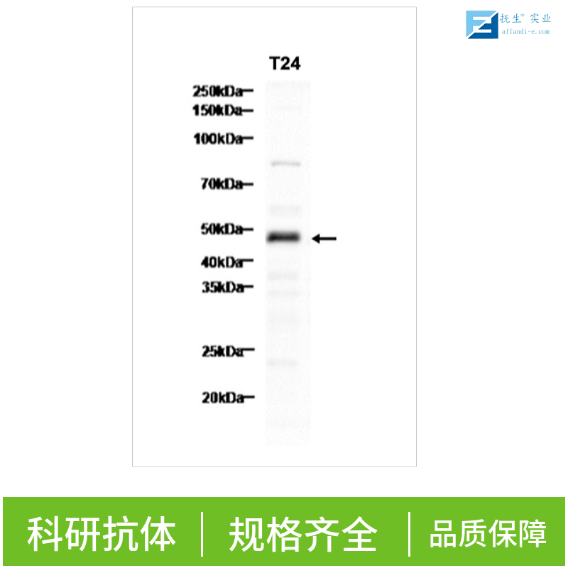 骨桥蛋白/分泌型磷蛋白1抗体,Osteopontin Rabbit pAb
