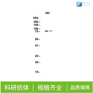 兜甲蛋白抗体,LOR/Loricrin Rabbit pAb