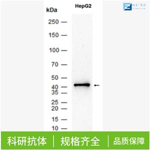 多药耐药相关蛋白2抗体,MRP2/ABCC2 Rabbit pAb
