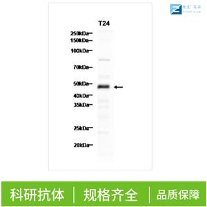 肺表面活性蛋白C抗体,SFTPC Rabbit pAb