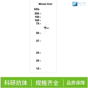 骨保护蛋白配体/破骨细胞分化因子抗体