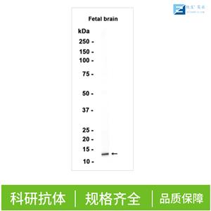 骨形态发生蛋白1/胶原C蛋白肽链内切酶抗体