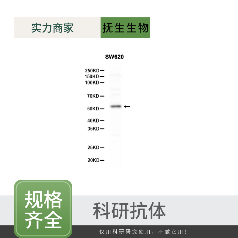 磷酸化粘着斑激酶抗体,Phospho-FAK (Tyr397) Rabbit pAb