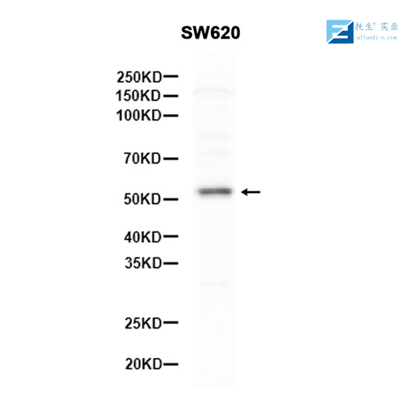牛病毒性腹泻病毒1型E2蛋白抗体,BVDV E2 Rabbit pAb