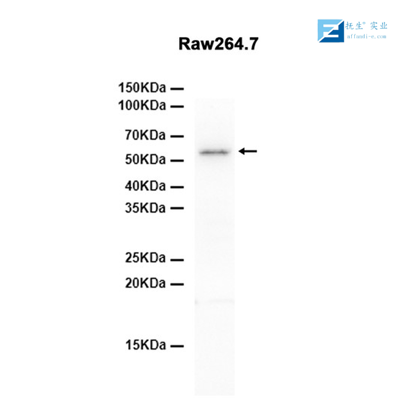 葡萄糖转运蛋白4抗体,GLUT4 Rabbit pAb