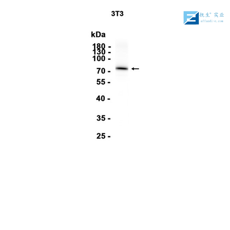 人类乳头状瘤病毒16/18 E6抗体,HPV16 E6 + HPV18 E6 Rabbit pAb