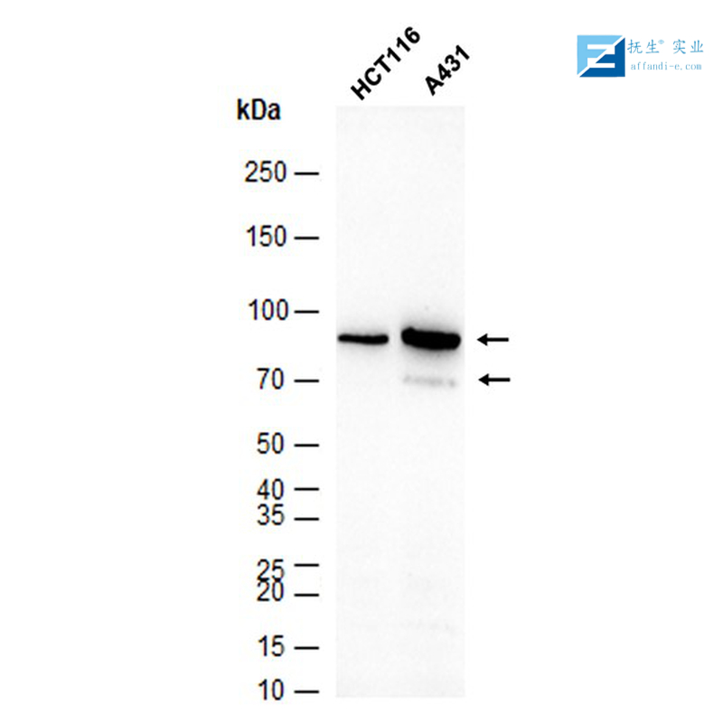 溶质载体有机阴离子转运蛋白家族成员1A1抗体,Slco1a1 Rabbit pAb