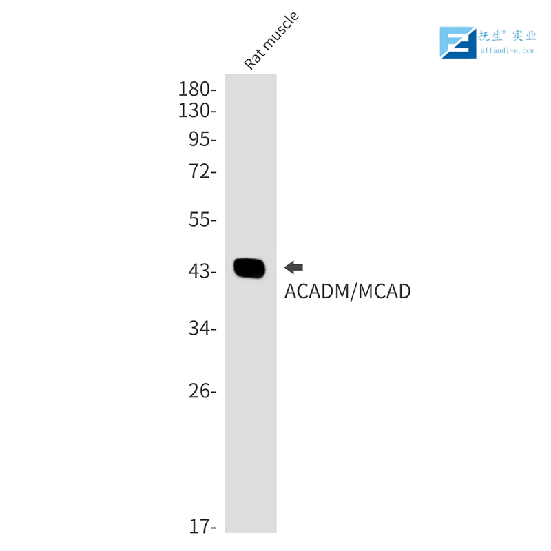 溶酶体相关膜蛋白1（CD107）抗体,LAMP1 Rabbit pAb