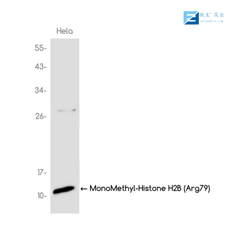 三磷酸腺苷门控阳离子通道蛋白抗体,P2RX4 Rabbit pAb