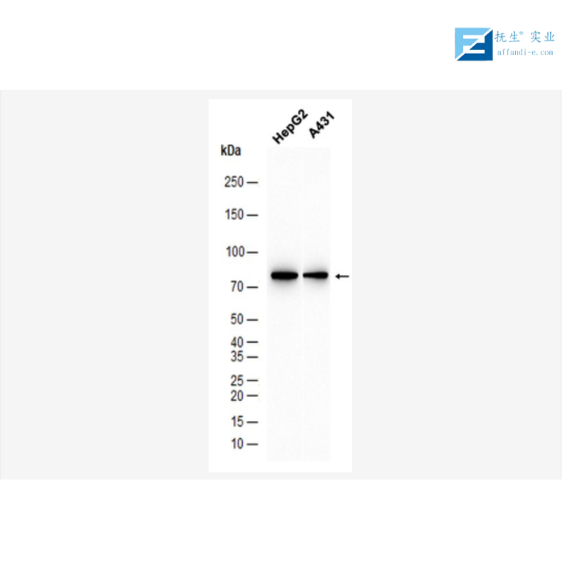 神经生长相关蛋白43单克隆抗体,GAP43 Mouse mAb
