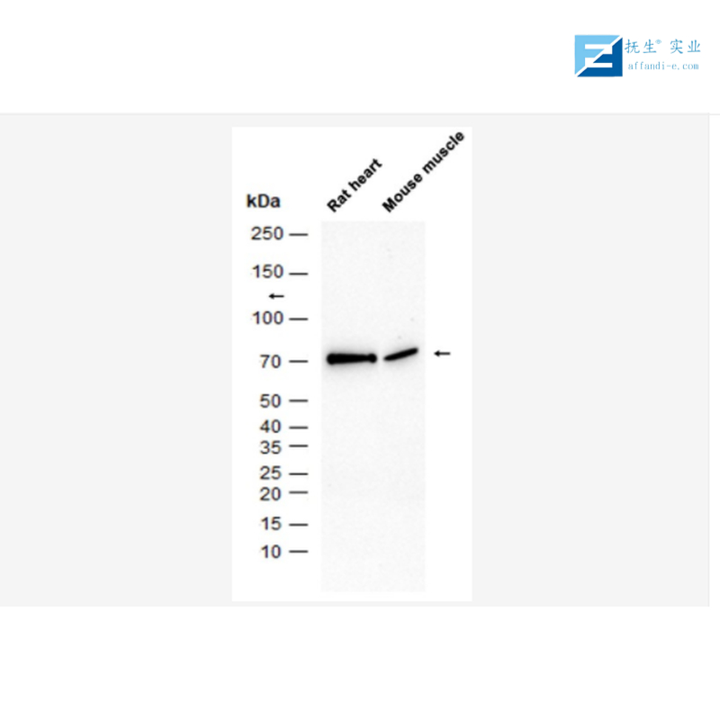神经丝蛋白单克隆抗体,AD7c-NTP Mouse mAb