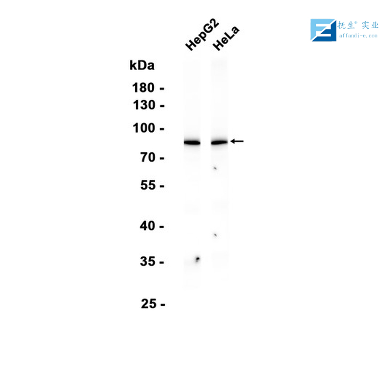 His tag标签抗体,His tag Rabbit pAb