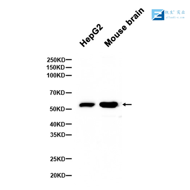 果蝇肌动蛋白（内参）抗体,Beta Actin (Fruit Fly) Rabbit pAb, Loading Control