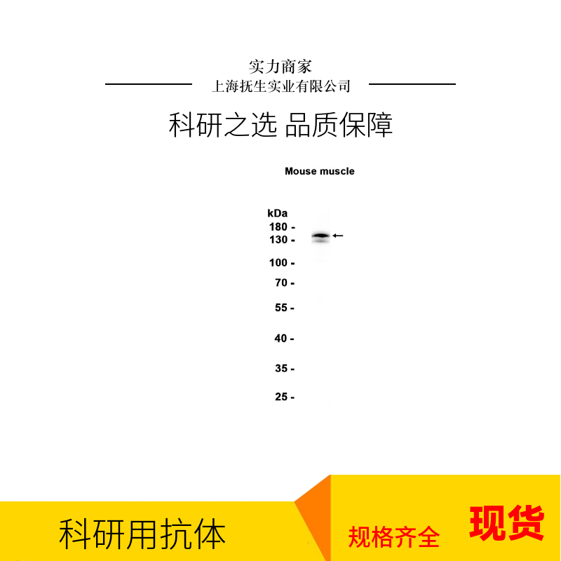 神经元抑制蛋白抗体,NRSF Rabbit pAb